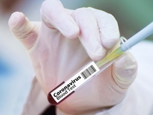 Szczepionka Pfizera działa słabiej przeciw nowej mutacji koronawirusa? 