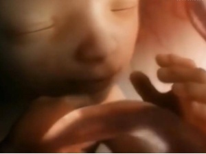 Aborcja jest przyzwoita, ale mówienie o niej już nie? Kuriozalna decyzja wrocławskiego Ratusza