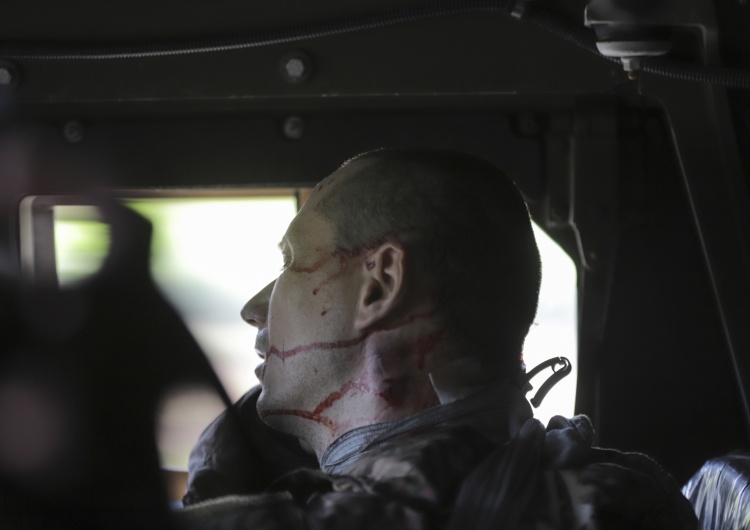 Ranny żołnierz ukraińskiego Legionu Cudzoziemskiego w Siewierodoniecku Szef rejonu siewierodonieckiego: Nasi chłopcy powoli wypierają przeciwnika z centrum Siewierodoniecka