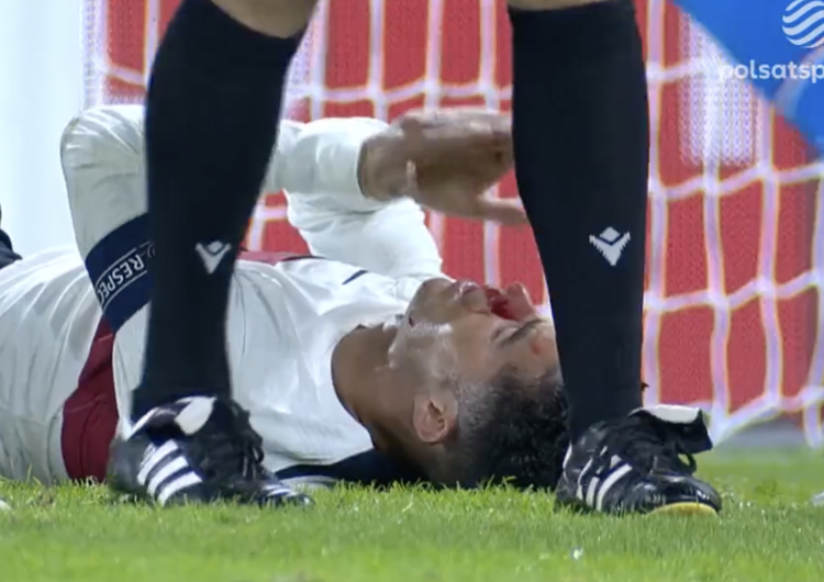  Cristiano Ronaldo zalał się krwią. Bramkarz po prostu go znokautował [WIDEO] 